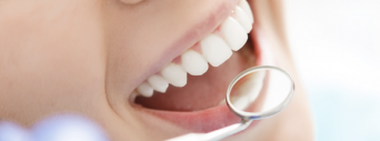 Planos Odontológicos atraem cada vez mais brasileiros
